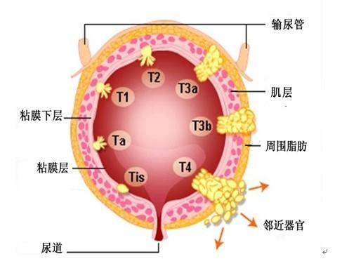 新澳门彩出号综合走势和抗癌2年后发现误诊与抗癌2年后发现误诊怎么办